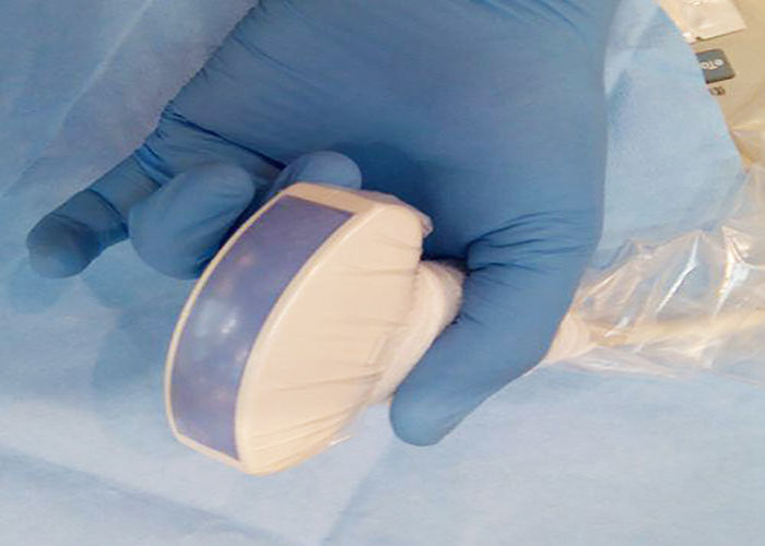As tampas amigáveis do transdutor do ultrassom de ECO a testar fornecem amostras grátis