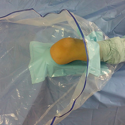 O Arthroscopy cirúrgico descartável médico do joelho drapeja o bloco/jogo