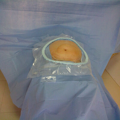 Pacotes cirúrgicos descartáveis de alta absorção com zonas críticas absorventes reforçadas e esterilização por EO para emergências hospitalares